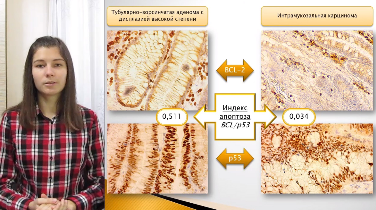 Анна Голышевская
