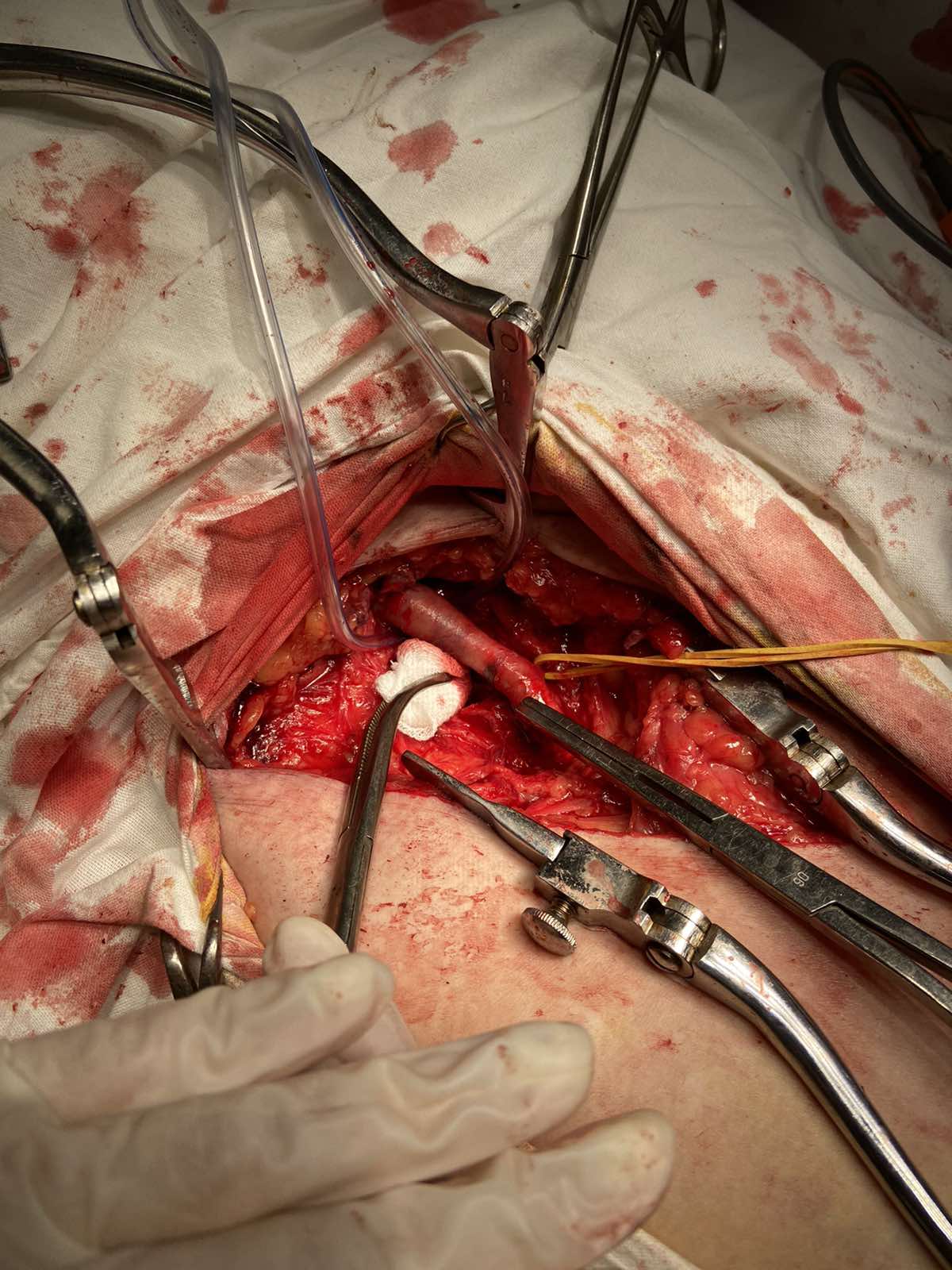 IMG-39b1b257e44037db219a27f6da22401b-V