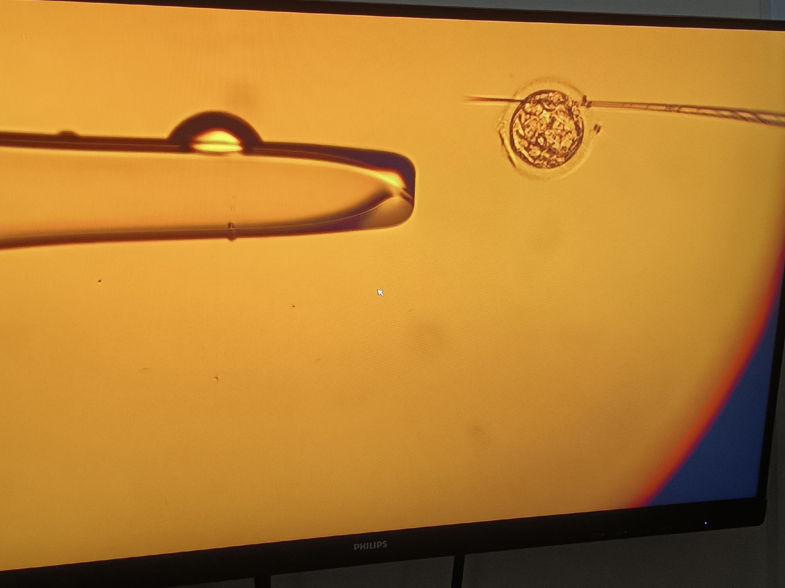 image-15-04-25-11-33-4